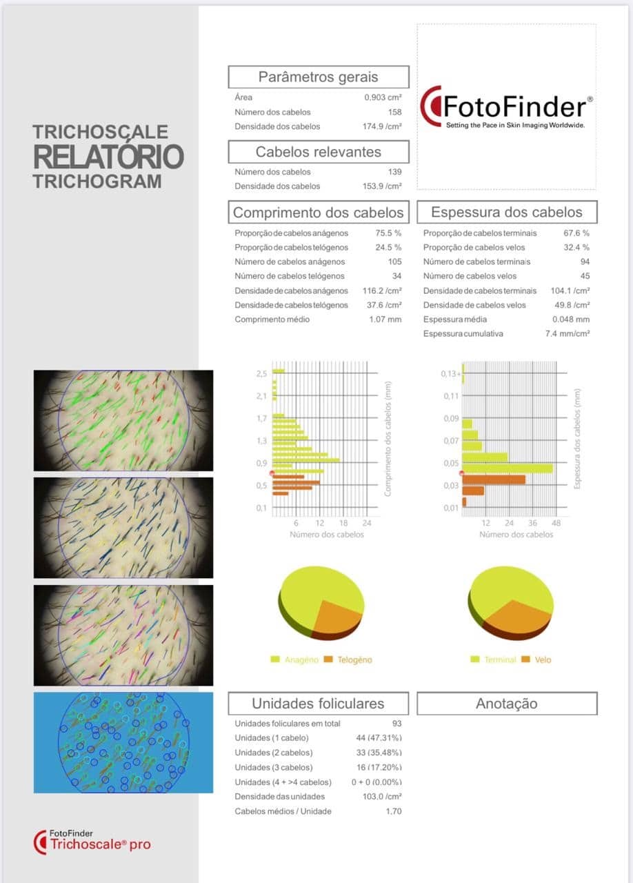 Tricograma – Dermatobrasilia.com.br